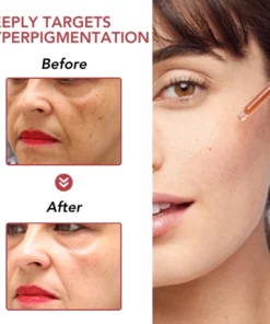 Fivfivgo™ Dunkler Fleck Niacin 10% Korrigierendes Serum