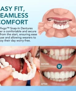 Fivfivgo™ Einrastbarer Zahnersatz