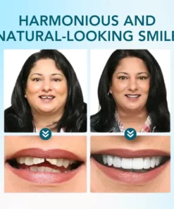 Fivfivgo™ Einrastbarer Zahnersatz