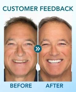 Fivfivgo™ Einrastbarer Zahnersatz