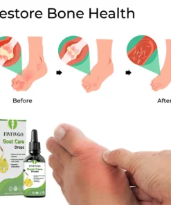 Fivfivgo™ Gicht-Pflege-Tropfen