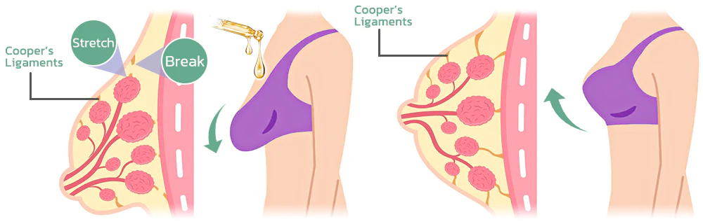 Fivfivgo™ Kollagen-Körperstraffungsöl
