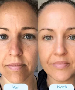 Fivfivgo™ Koreanische Bio-Kollagen Echt Tiefenmaske