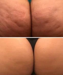 Fivfivgo™ LuxeLift Hautstraffende Jugendbutter