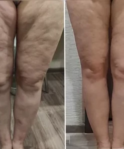 Fivfivgo™ LuxeLift Hautstraffende Jugendbutter