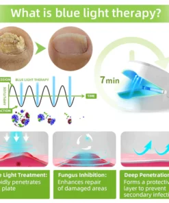 Fivfivgo™ Nagelpilz Laser-Behandlungsgerät