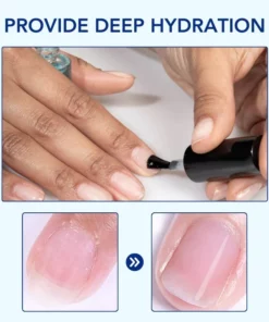 Fivfivgo™ OnyxoGuard Wachstum der Nägel und Reparaturserum