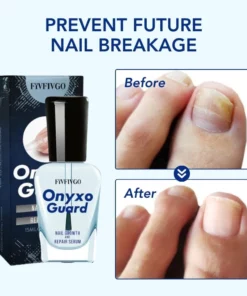 Fivfivgo™ OnyxoGuard Wachstum der Nägel und Reparaturserum