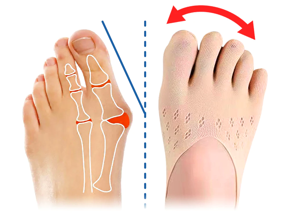 Fivfivgo™ Orthopädisch Ballenzeh Erleichterung Socken