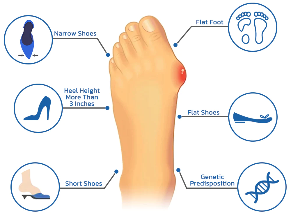 Fivfivgo™ Orthopädisch Ballenzeh Erleichterung Socken