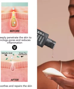 Fivfivgo™ PoreClear 2% BHA Hauterneuerung Flüssigkeit