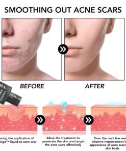 Fivfivgo™ PoreClear 2% BHA Hauterneuerung Flüssigkeit