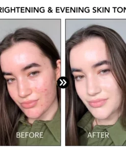 Fivfivgo™ PoreClear 2% BHA Hauterneuerung Flüssigkeit