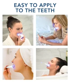 Oveallgo™ ProTeeth Whitening Kit