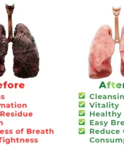 Fivfivgo™ RespiAid Kräuterlunge Reinigungsspray