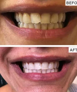 Fivfivgo™ SP-Y6 Probiotische schnell aufhellende Zahnpasta