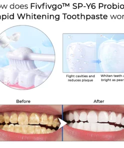 Fivfivgo™ SP-Y6 Probiotische schnell aufhellende Zahnpasta