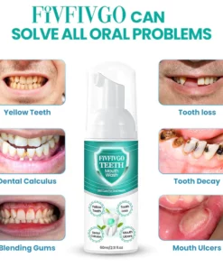 Fivfivgo™ Teeth Herbal Mouthwash – Lösen Sie alle Mundprobleme