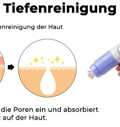 Fivfivgo™ Ultraschall-Porenabsauger BlackheadRemover PoreVacuum