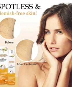 Fivfivgo™ Warze und Tags Entfernungsbehandlungsspray