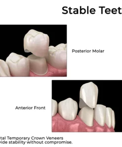 Fivfivgo™ Zahnprovisorische Kronenveneers für die Abdeckung der vorderen/hinteren Backenzähne