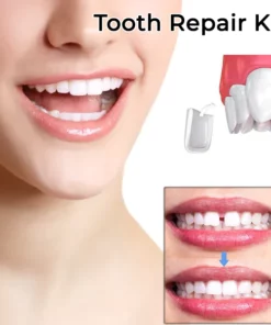 Fivfivgo™ Zahnprovisorische Kronenveneers