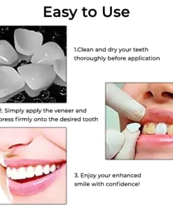 Fivfivgo™ Zahnprovisorische Kronenveneers