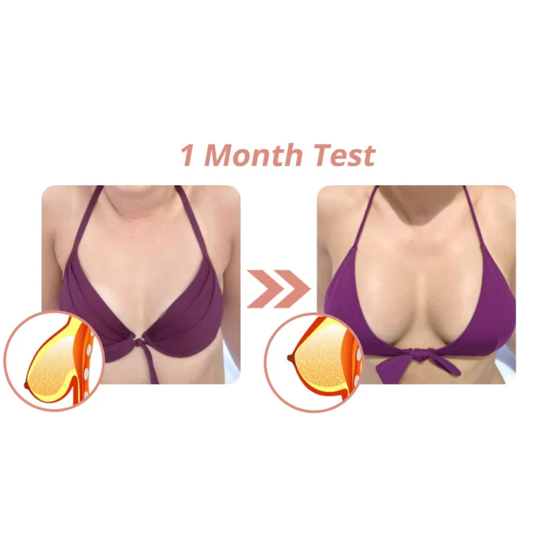 Flysmus™ Breast Augmentation Patch