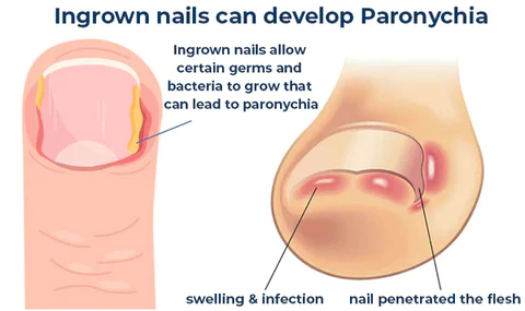 FootHealth™ Foot Bath Therapy Gel Beads