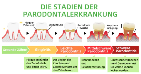 Furzero™ Kräuterhelles Mundreparatur-Schaum