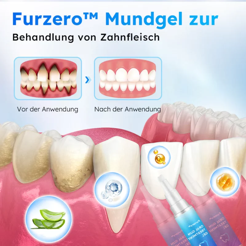 Furzero™ Oral Gel zur Zahnfleischbehandlung