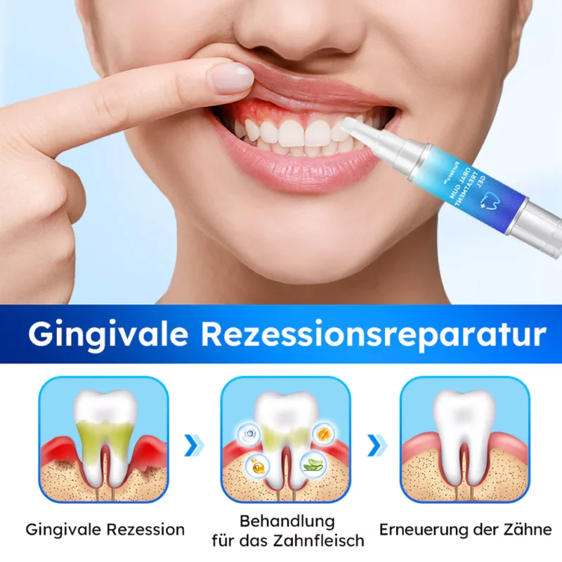 Furzero™ Oral Gel zur Zahnfleischbehandlung