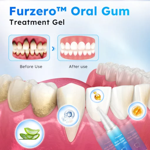 Gel de tratamento de gengiva oral Furzero™