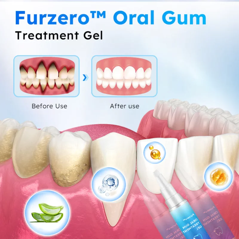 Furzero™ Oral Ọkpụkpụ Gel