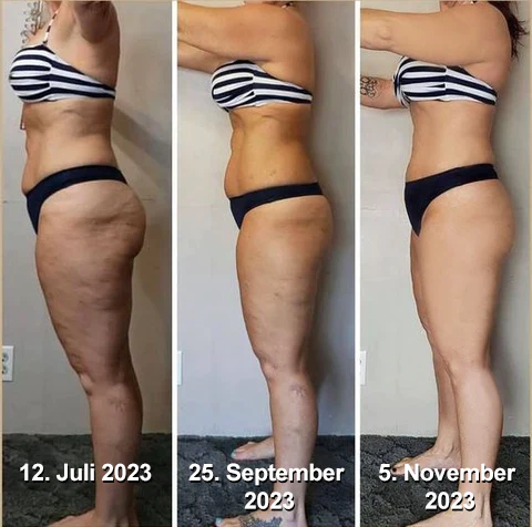 Furzero™ Beauty Frauen Kollagen Straffendes Körperöl