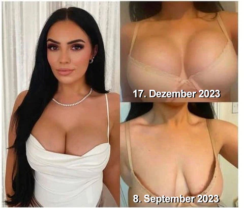 Furzero™ Beauty Frauen Kollagen Straffendes Körperöl