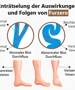 Furzero™ Bienengift Krampfadern Creme