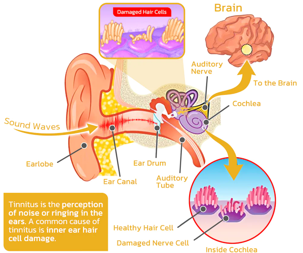 Furzero™ BuzziDrop Ear Buzzing Spray