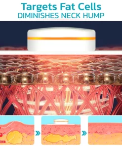 Furzero™ ChillNeck Ultrasonic Lymphatic Therapeutic Massager