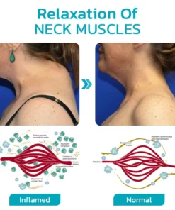 Furzero™ ChillNeck Ultrasonic Lymphatic Therapeutic Massager