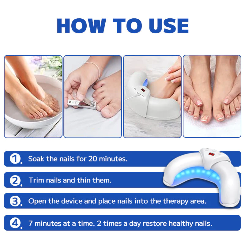 Furzero™ Fungal Nail Treatment Laser Device
