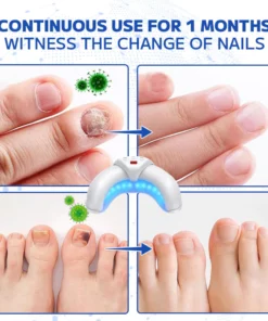 Furzero™ Fungal Nail Treatment Laser Device