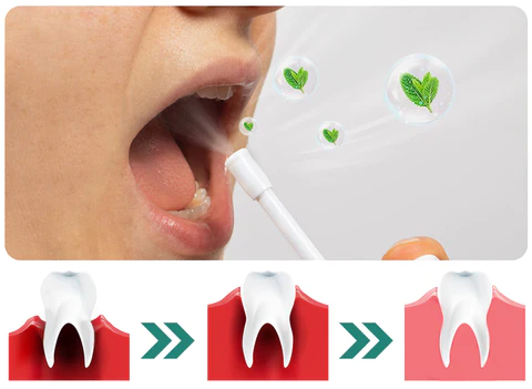 Furzero™ Herbal Mouth Spray