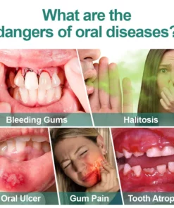 Furzero™ Herbal Mouth Spray