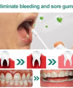 Furzero™ Herbal Mouth Spray