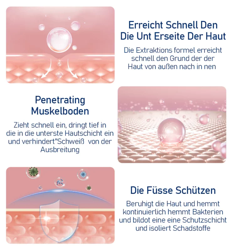 Furzero™ Medizinisches Nagelpilz-Fußspray