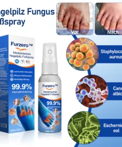 Furzero™ Medizinisches Nagelpilz-Fußspray