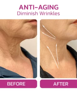 Furzero™ NECKUP Collagen Potentiating Neck Cream