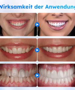 Furzero™ Oral Gel zur Zahnfleischbehandlung