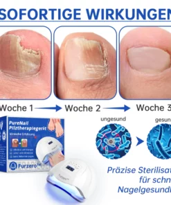 Furzero™ PureNail Pilz-Lasertherapiegerät